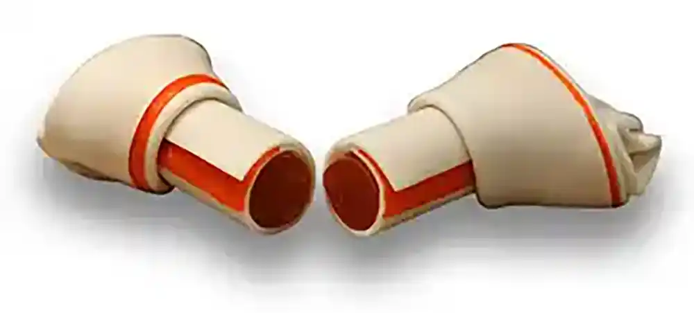 Bone